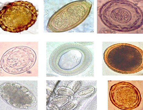 Collage of various helminth eggs